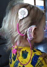 Skórka na procesor Cochlear NUCLEUS 6 - MORO
